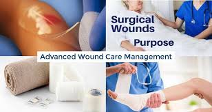 Wound Management