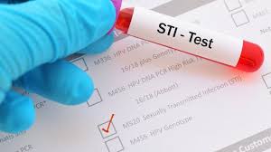 Sexual Health - Test Kits