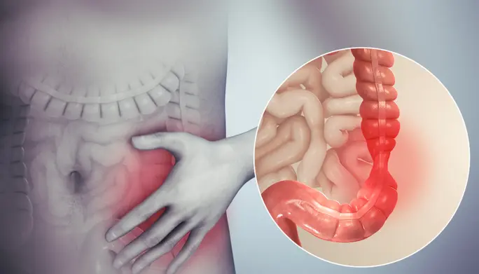 Bladder & Bowel